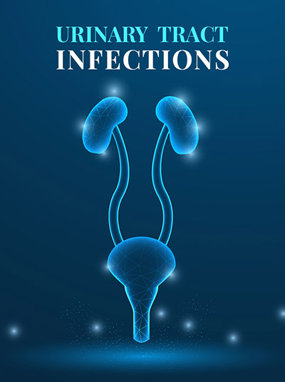 UT Vista for urinary tract infection original 